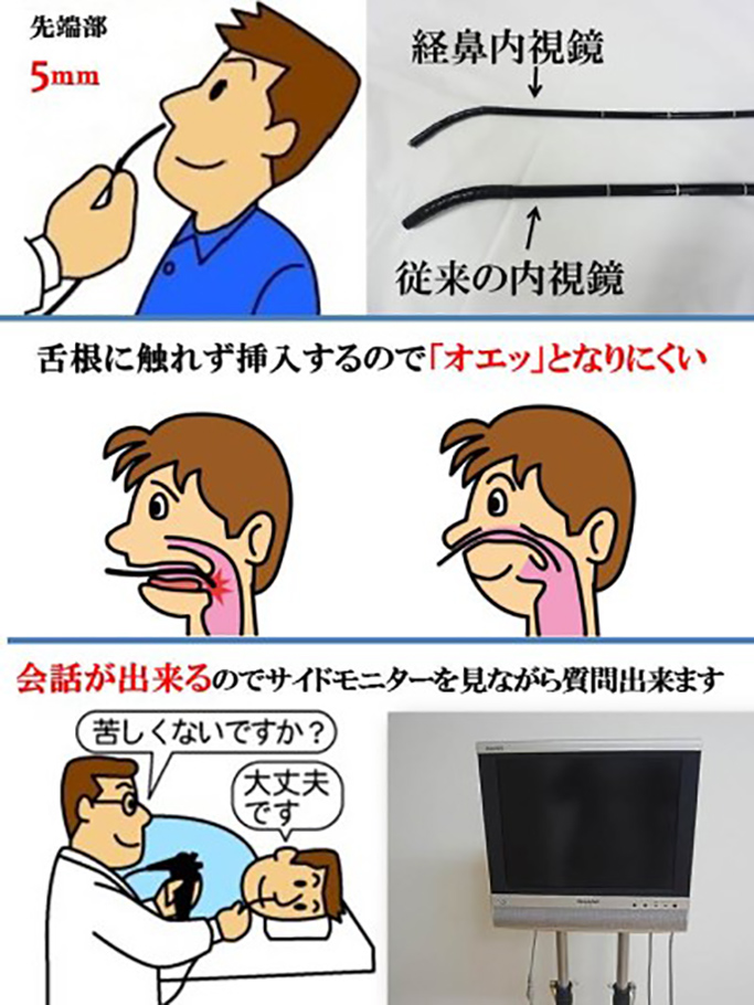 経鼻内視鏡